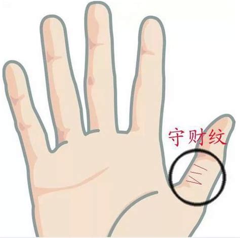 大拇指第二節橫紋